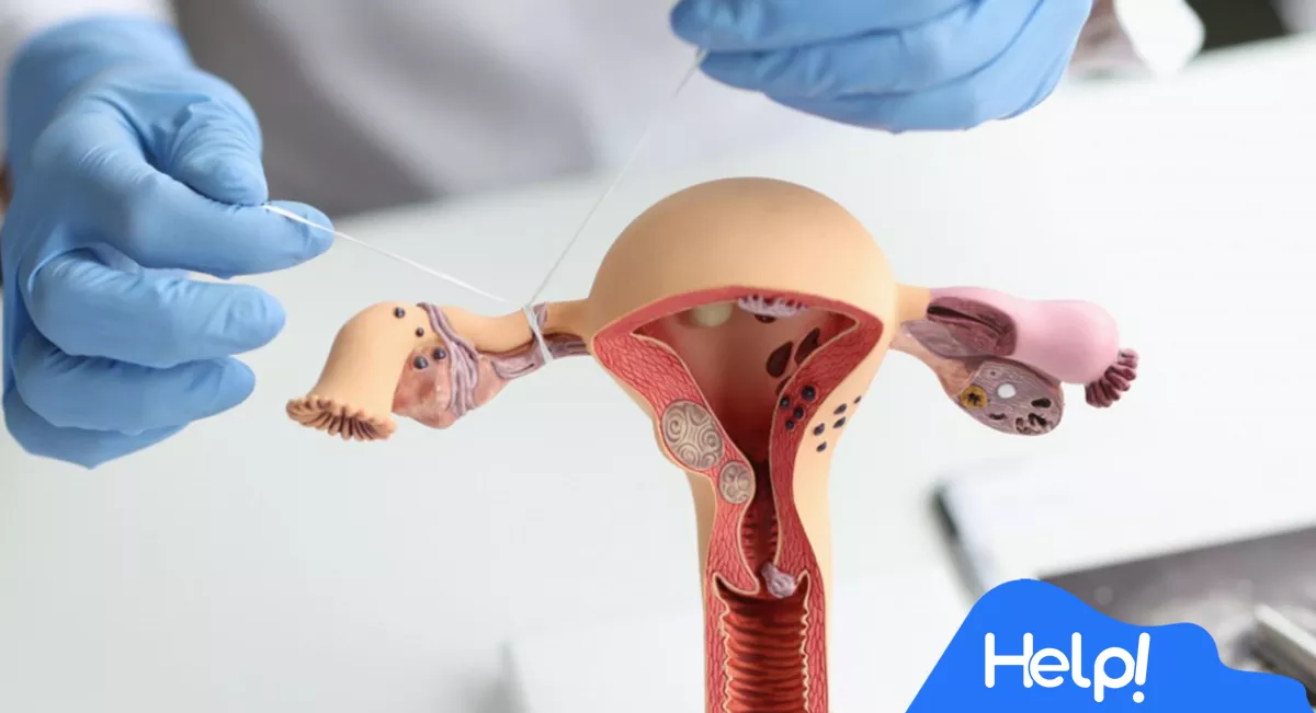 Laqueadura: O que é, como funciona e quem pode fazer? ⚕️👩‍⚕️